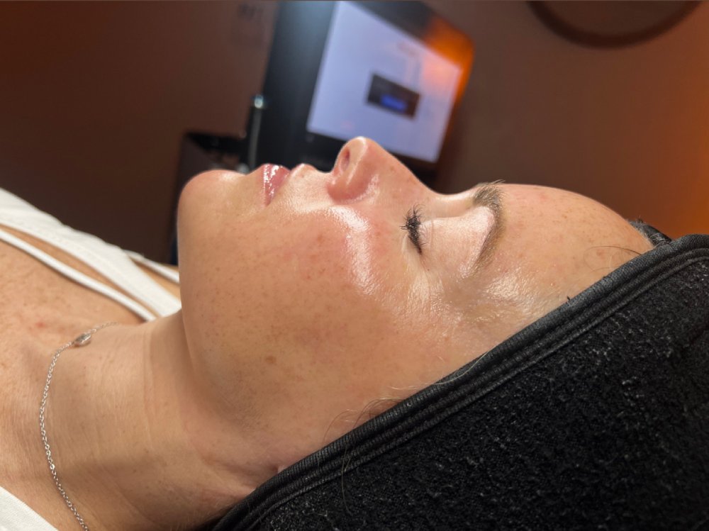 hydrafacial-ok